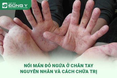 noi-man-do-ngua-o-chan-tay