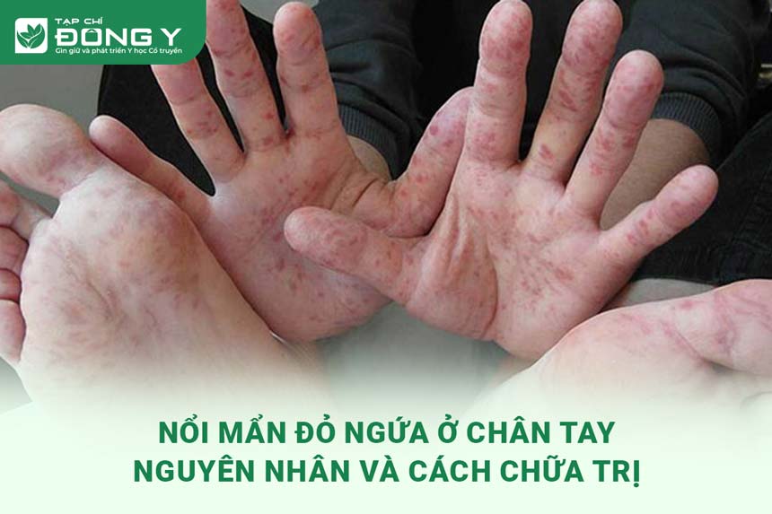 noi-man-do-ngua-o-chan-tay