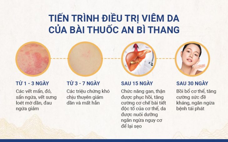 Tiến triển điều trị có thể cảm nhận rõ qua từng ngày