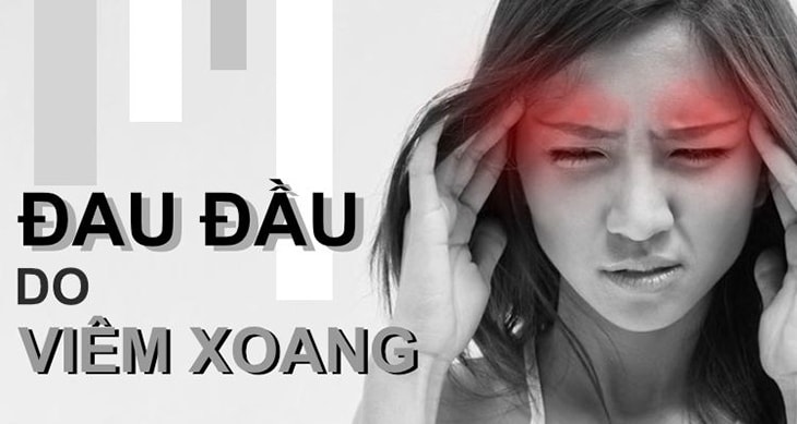 Biểu hiện rõ rệt của bệnh là đau đỉnh đầu, hai thái dương