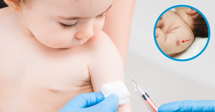 Sau khi tiêm phòng, bệnh nhân cần được chú ý theo dõi để xác định những phản ứng phụ nếu có