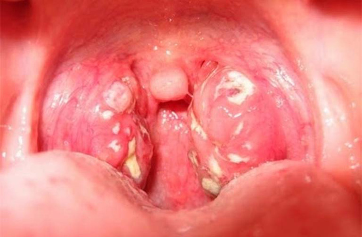 Bệnh do nhiều nguyên nhân khác nhau