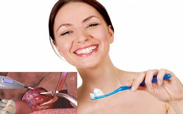 Vệ sinh khoang miệng sạch sẽ để phòng tránh biến chứng