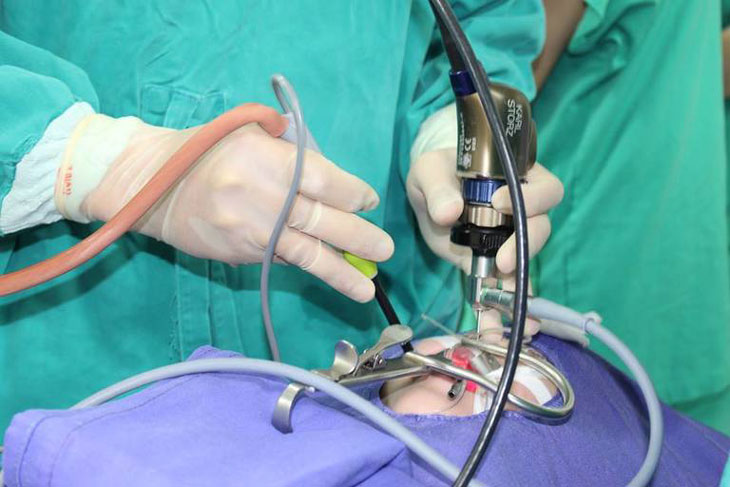 Cắt amidan chỉ được chỉ định khi việc dùng thuốc không phát huy hiệu quả