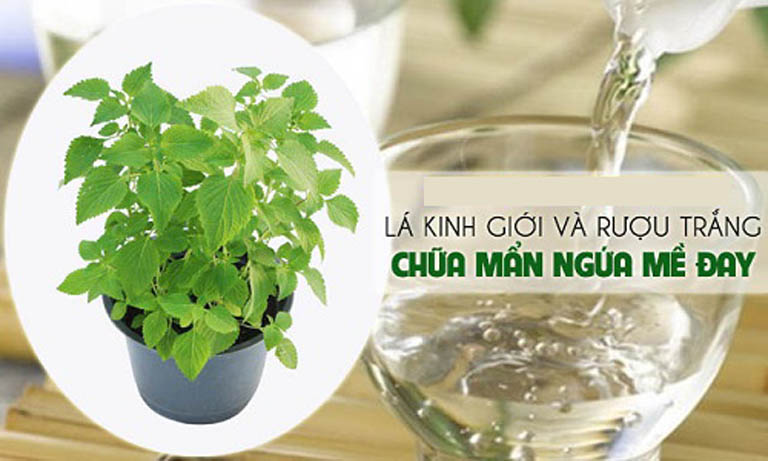 Trị mề đay bằng rượu và lá kinh giới, kết quả rất tốt