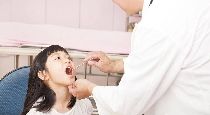 Phương pháp Tây Y đạt hiệu quả điều trị cao trong hầu hết mọi trường hợp viêm họng 