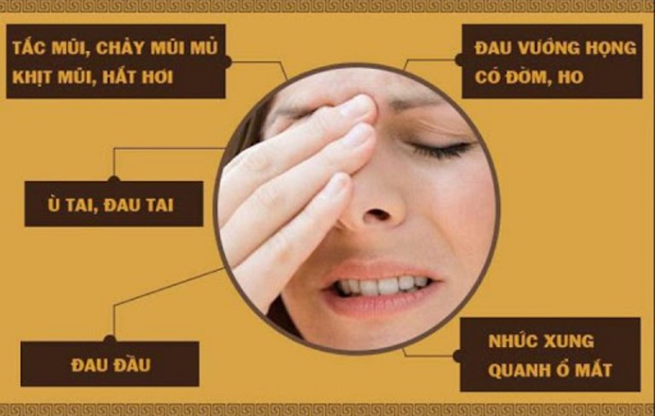 Một số tình trạng đau của viêm xoang