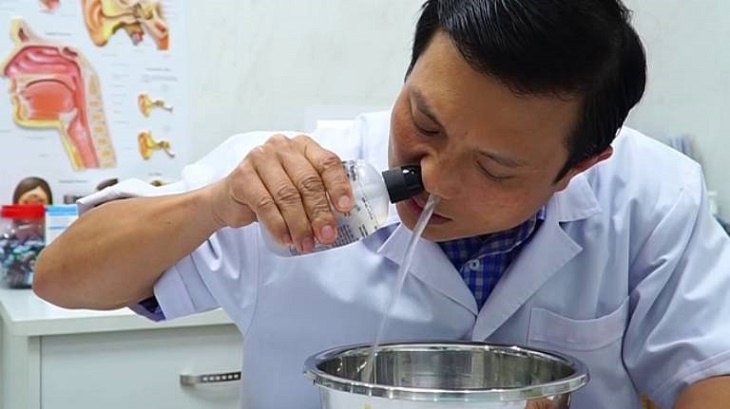 Vệ sinh mũi hàng ngày bằng nước muối sinh lý để giảm viêm