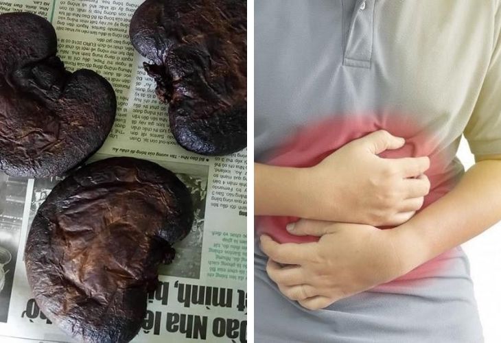 Dạ dày nhím chữa đau dạ dày được đánh giá an toàn hiệu quả