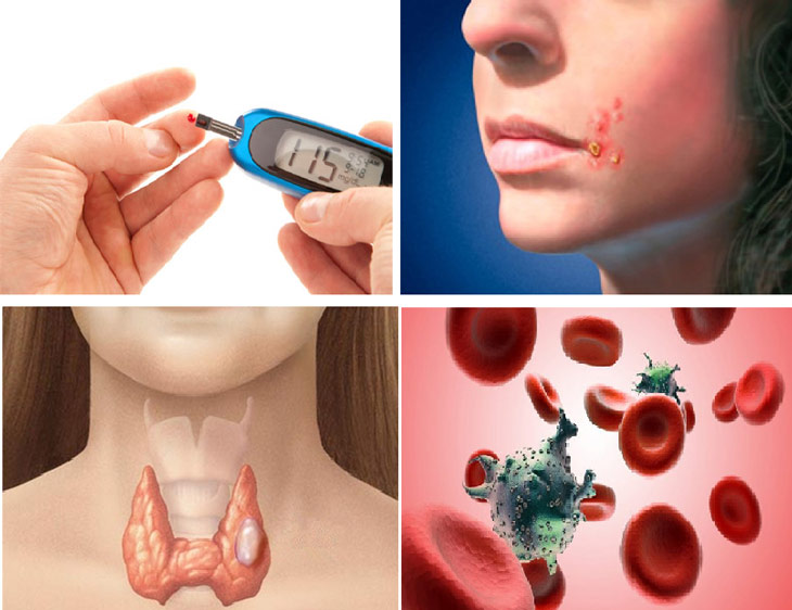 Mất ngủ sụt cân cảnh báo nhiều bệnh tật nguy hiểm