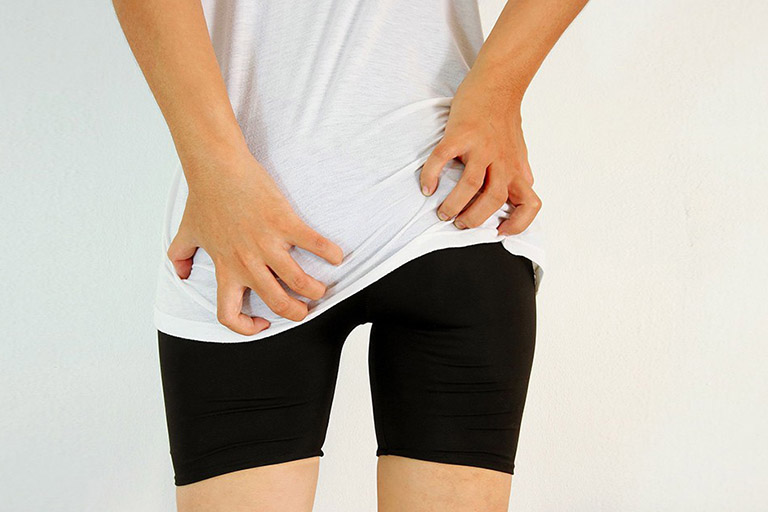 Nổi mẩn ngứa ở mông có thể gây nên nhiều phiền toái, bất tiện