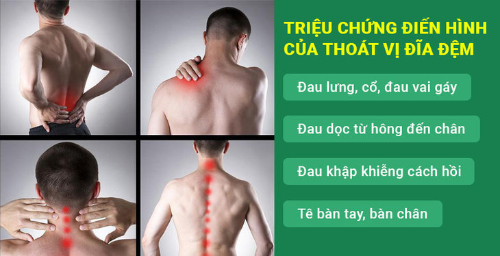 Triệu chứng thoát vị