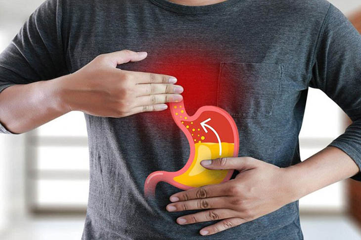 Viêm họng trào ngược dạ dày thực quản gây khó chịu cho người bệnh