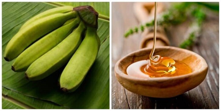 Bật mí cách chữa viêm loét dạ dày bằng mật ong và chuối xanh