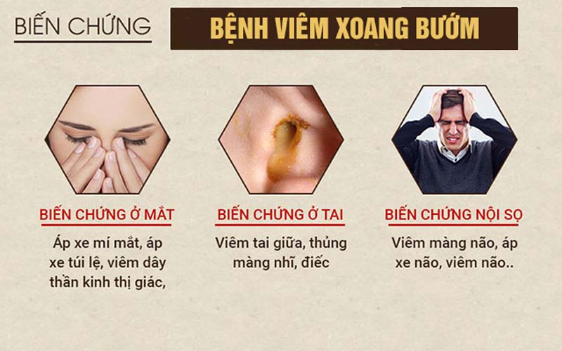 Các biến chứng viêm xoang bướm