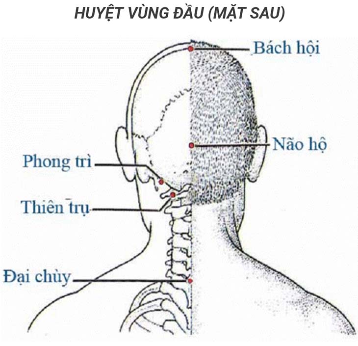 Điều trị viêm tai giữa bằng phương pháp Đông y bấm huyệt, châm cứu huyệt phong trì Điều trị viêm tai giữa bằng phương pháp Đông y bấm huyệt, châm cứu huyệt phong trì