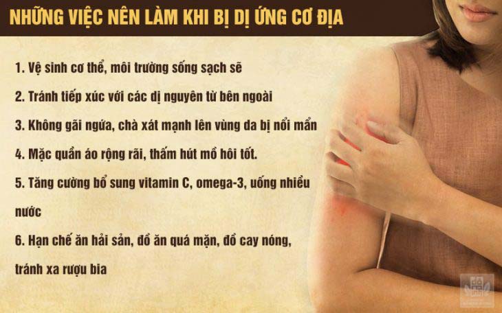Lưu ý dành cho người bị viêm da cơ địa