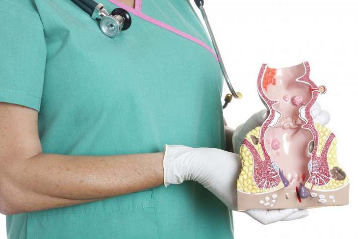 Để xác định tình trạng của bệnh trĩ, bác sĩ sẽ tìm hiểu nhiều vấn đề liên quan đến chế độ ăn, sinh hoạt