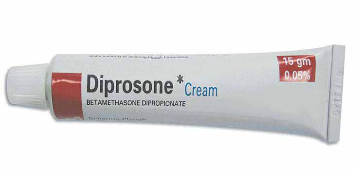 Thuốc bôi trị vảy nến da đầu Diprosone Thuốc bôi trị vảy nến da đầu Diprosone