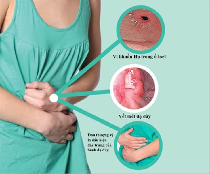 Công dụng của thuốc dạ dày dạng dạng bột An Bình Công dụng của thuốc dạ dày dạng dạng bột An Bình