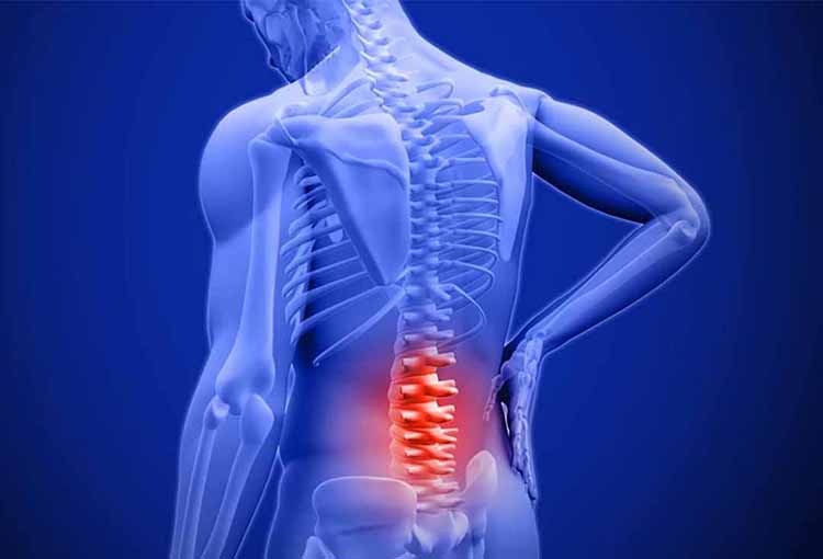 Phương pháp X-quang cột sống giúp chẩn đoán sớm những bệnh lý xương khớp