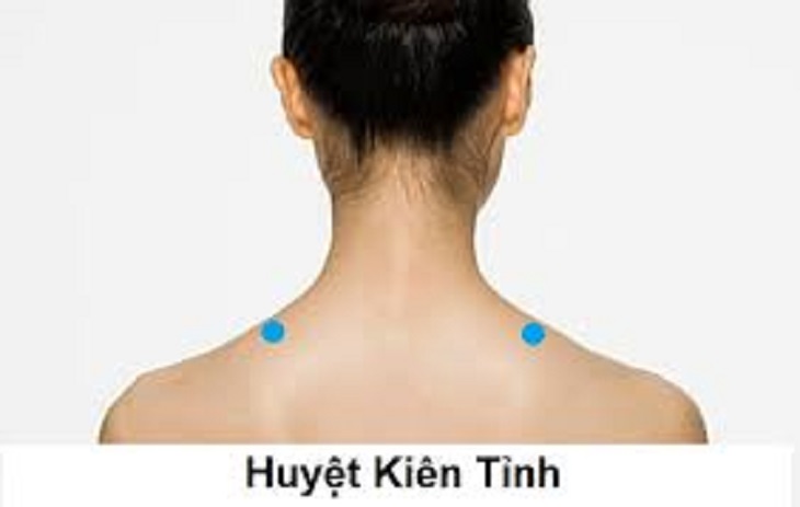 Bấm huyệt Kiên Tỉnh giúp làm giảm áp lực ở vai và cổ, từ đó giảm các cơn đau cổ và ngăn ngừa cảm giác đau đầu