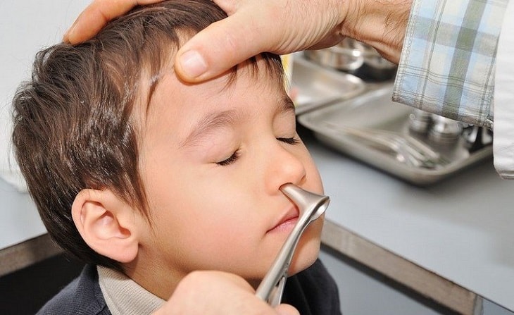 Để áp dụng cách chữa viêm xoang cho trẻ em, cha mẹ cần đưa trẻ đến bệnh viện để thăm khám và chẩn đoán bệnh