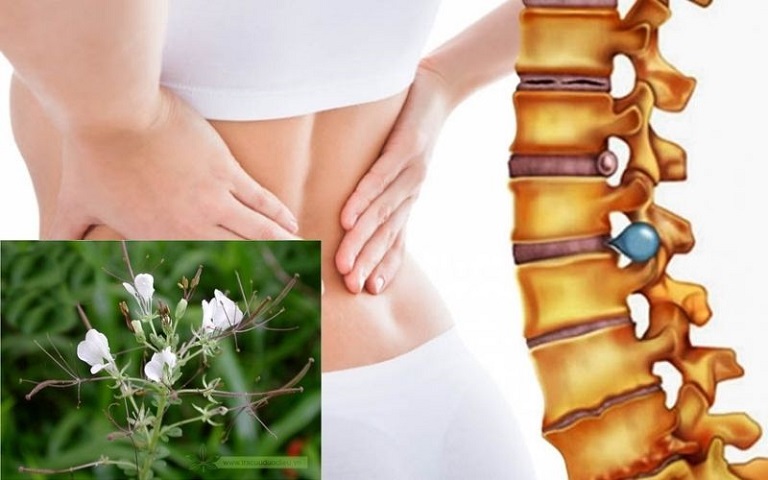 Cây mần ri chữa thoát vị đĩa đệm có hiệu quả không? Hướng dẫn cách dùng tốt nhất