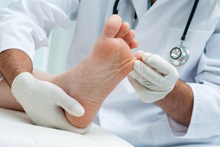 Người bị bệnh tổ đỉa cần điều trị theo hướng dẫn của bác sĩ