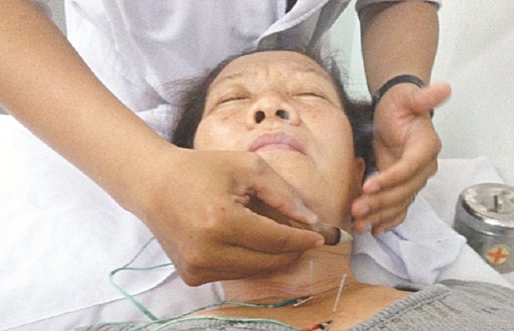 Có thể phối huyệt Liêm Tuyền với các huyệt đạo khác để điều trị bệnh