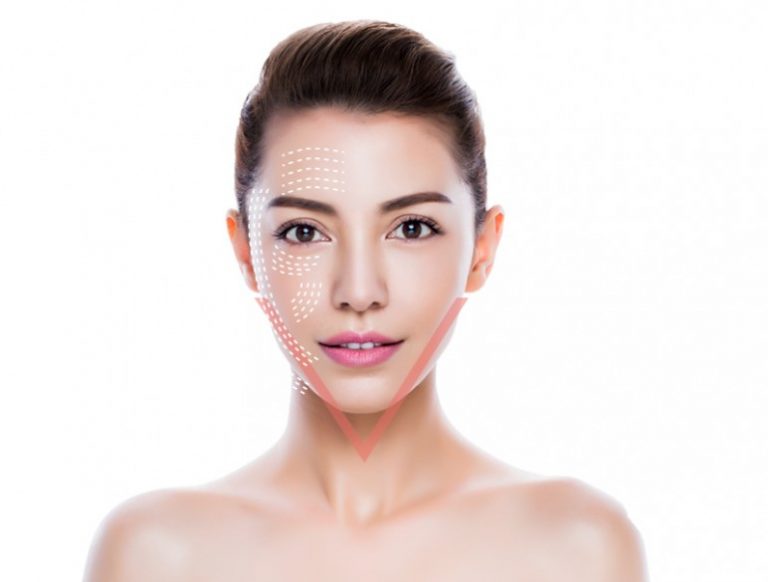 cay-chi-collagen-1