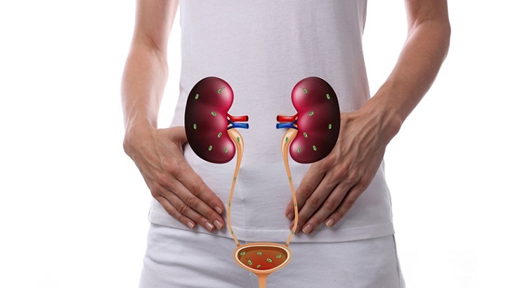 Suy thận độ 2 do nhiều nguyên nhân gây ra.