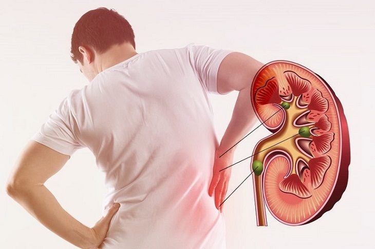 Mặc dù suy thận ở cấp độ này là mức độ nhẹ nhưng chức năng của thận đã suy giảm dần dần và không thể hồi phục 100% như bình thường