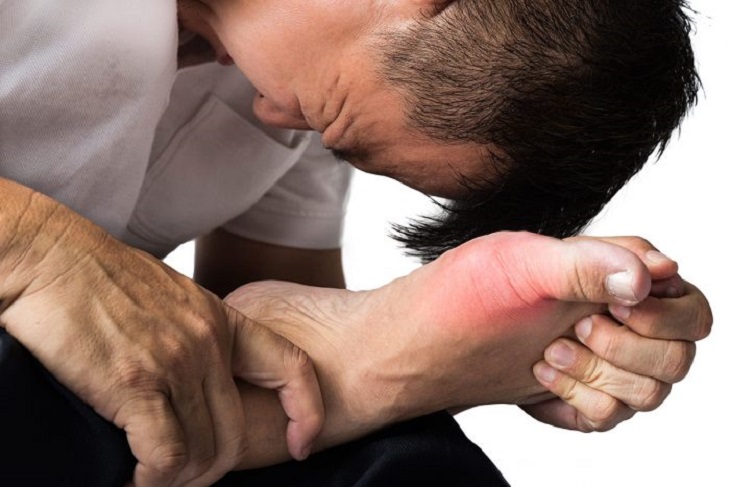 Biến chứng của gout ảnh hưởng trực tiếp đến cuộc sống hằng ngày