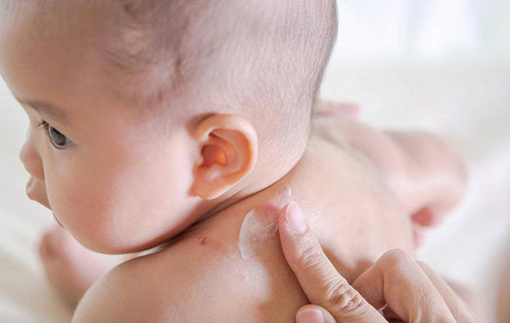 Khi chăm sóc trẻ có làn da khô, bậc phụ huynh cần lưu ý một số điều sau để không ảnh hưởng đến làn da mỏng, yếu của trẻ nhỏ