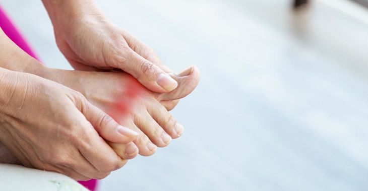 Trước khi điều trị, bác sĩ sẽ chẩn đoán bệnh gout