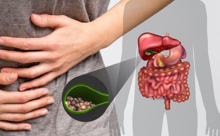Chẩn đoán và điều trị sỏi mật là biện pháp cần thiết