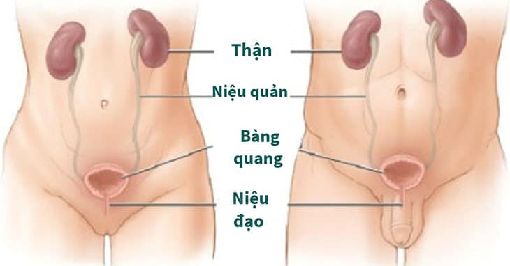 Sỏi thận có thể gây viêm nhiễm, tắc nghẽn đường tiết niệu