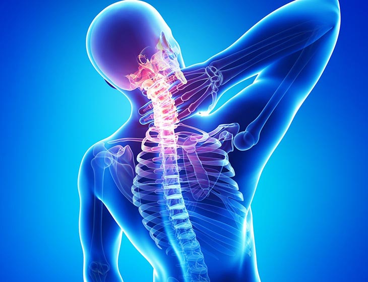 Chụp X-quang cột sống là kỹ thuật phổ biến trong chẩn đoán hình ảnh hiện nay