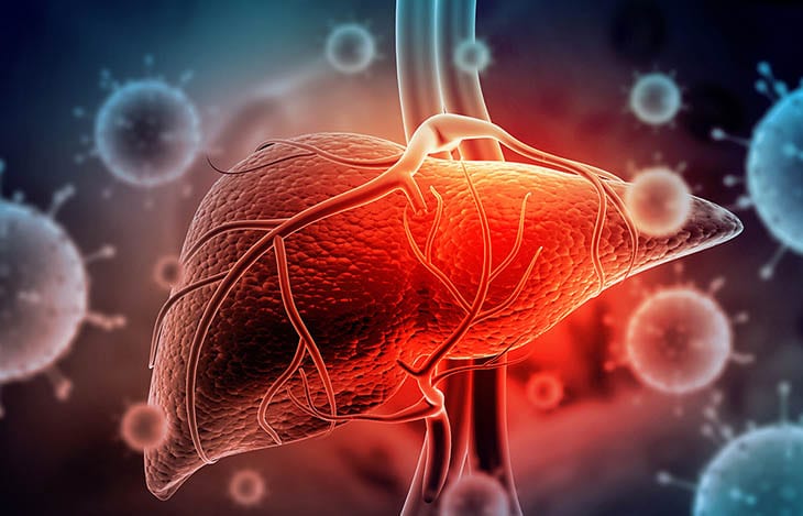 Chỉ dấu ung thư gan còn có DCP Decarboxyl prothrombin