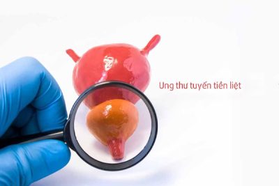 hinh-anh-benh-vien-ung-buou-co-so-15