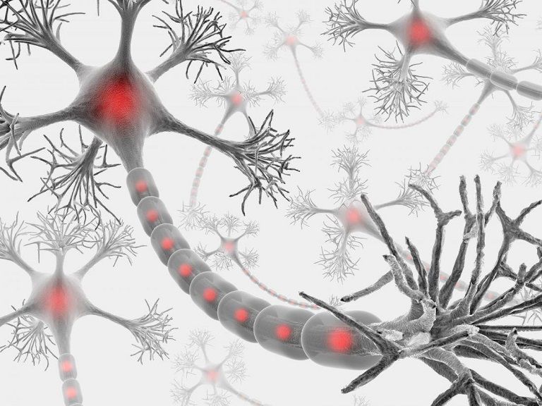 CIDP là bệnh viêm đa dây thần kinh huỷ myelin 