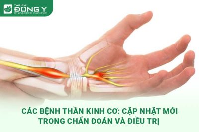 cac-benh-than-kinh-co