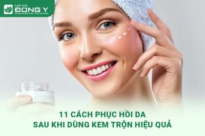cach-phuc-hoi-da-sau-khi-dung-kem-tron
