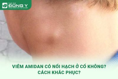 viem-amidan-co-noi-hach-o-co-khong