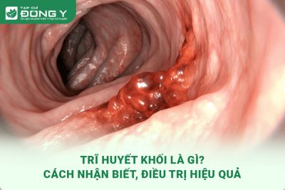 tri huyet khoi