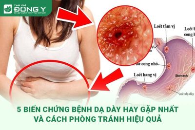 bien-chung-benh-da-day