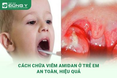 cach-chua-viem-amidan-o-tre-em