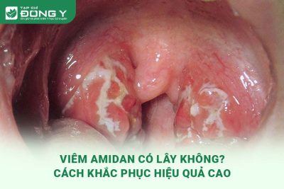 viem-amidan-co-lay-khong