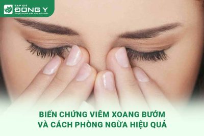 bien-chung-viem-xoang-buom